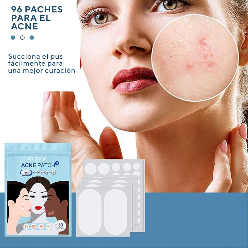 PARCHES PARA ACNE